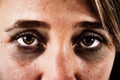 que podemos hacer para quitar las ojeras oscuras